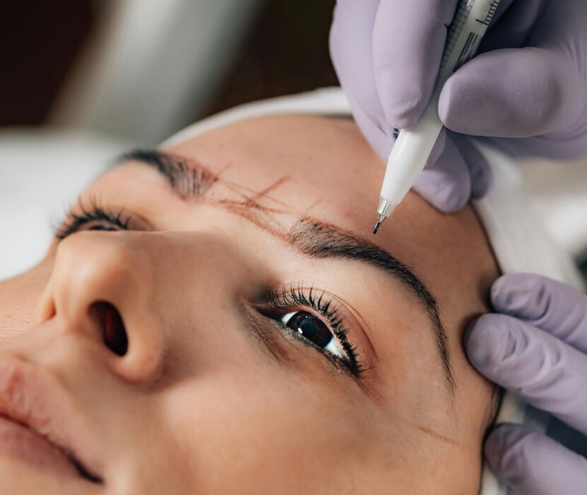 Close-up of a person receiving an eyebrow microblading procedure, with a technician using a precision tool, wearing purple gloves.